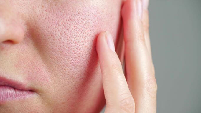 You Can Shrink Your Pores with Products