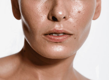 Oily Skin: How to Control Excess Oil and Achieve a Matte, Healthy Complexion