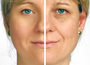 Wrinkles: How to Reduce Fine Lines and Keep Your Skin Youthful