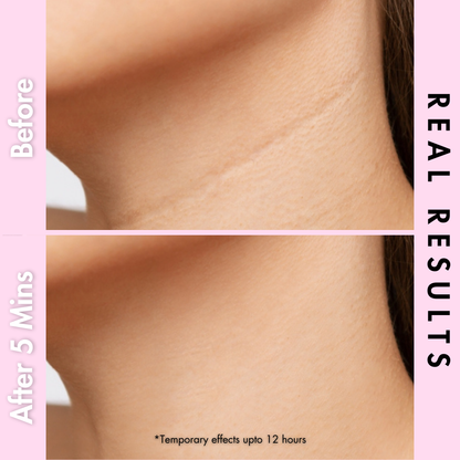 neck firming by  dr crazy results